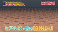 7899:7:00000174.jpg